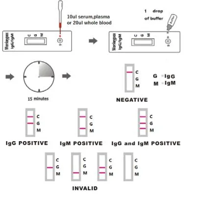 Factory Price Wholesale One Step Mpxv Igg/Igm Test with CE